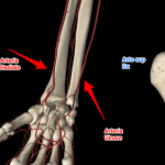 L'infermiere e il prelievo di sangue arterioso