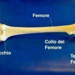 Tempi più rapidi per le fratture del femore