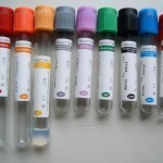 Giulianova, €200 per "ripulire" le provette dei test antidroga: arrestato infermiere