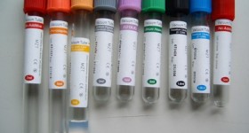 Giulianova, €200 per "ripulire" le provette dei test antidroga: arrestato infermiere
