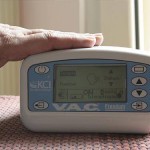 V.A.C. Therapy e il trattamento delle lesioni da pressione 8