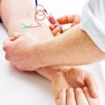Anticorpi ANA nel sangue: interpretare i risultati