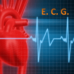 Posizionamento elettrodi ECG nel lattante  e nell’adulto 1