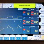 Ventilazione meccanica domiciliare: variabili di controllo e modalità di ventilazione