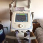 Ventilazione meccanica domiciliare: il respiratore