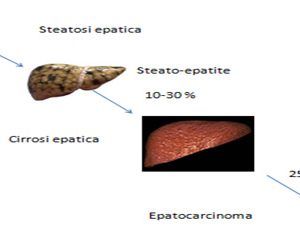 steatosi-epatica