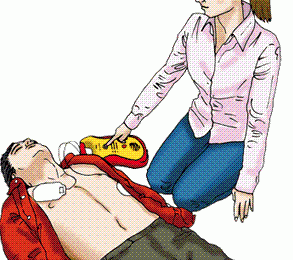 La defibrillazione: responsabilità e criticità infermieristiche