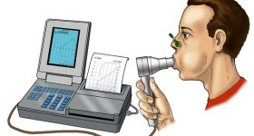 La spirometria: cos'è e a cosa serve