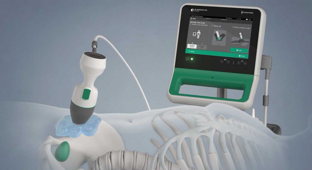 Disuria dopo rimozione del catetere vescicale, come gestirla usando il bladder scanner Nurse Times