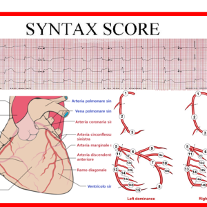Syntax Score: indice di anatomia coronarica