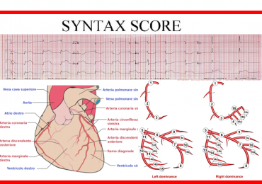 Syntax Score: indice di anatomia coronarica