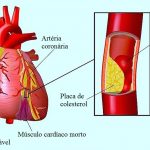 Rivaroxaban ed Aspirina: impiego singolo ed in associazione. Lo studio