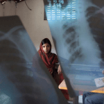 Tubercolosi, il primo killer infettivo secondo i dati dell’OMS