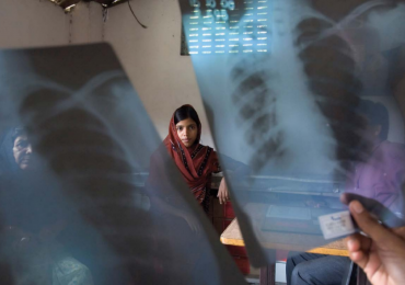 Tubercolosi, il primo killer infettivo secondo i dati dell’OMS