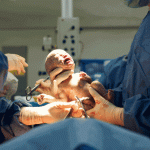 Donna nata senza utero partorisce grazie ad una tecnica rivoluzionaria