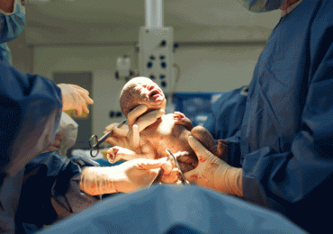 Donna nata senza utero partorisce grazie ad una tecnica rivoluzionaria