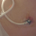 Gestione del sito di emergenza dei PICC