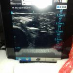 In Calabria eccellenza infermieristica: il Picc Team diventa Vascular Team Oncology 2