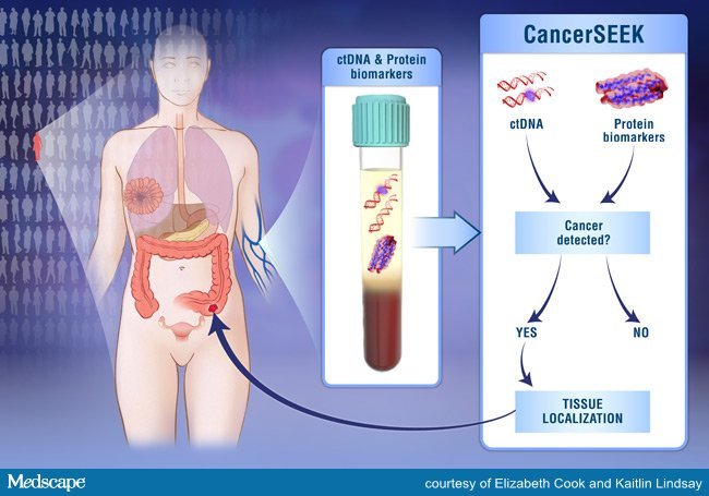 CancerSEEK: con un prelievo di sangue si potrà diagnosticare precocemente il Cancro?