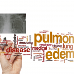 Cause non cardiogene di edema polmonare 1