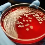 Rischio infettivo, il ruolo centrale dell’infermiere