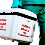 Vagina artificiale con tessuto suino : nuova frontiera per trapianti d'organo? 1