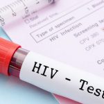 Hiv e droghe iniettive: negli Stati Uniti causano più morti delle guerre