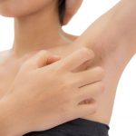 La storia di Anna colpita da un linfoma di Hodgkin "Anche se è stata dura, ce l’ho fatta!"