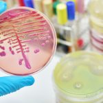 Setticemia, ecco il test rapido per la diagnosi