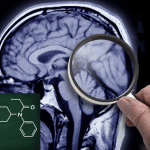 Sindrome amnestica acuta e sovradosaggio di fentanyl