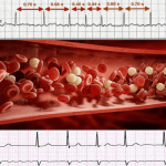 Utilizzo anticoagulanti orali in pazienti con fibrillazione atriale: le Linee guida 2018