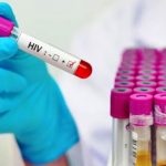 Via libera alla donazione di organi tra pazienti Hiv positivi