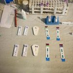 In Veneto nasce il primo programma per debellare epatite C