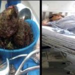 Non sente più muoversi il bambino: aveva un chilo di marijuana nell’utero 1