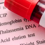Talassemia, la medicina fa progressi