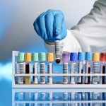 Biopsia liquida: con un semplice prelievo ematico precoce dei tumori