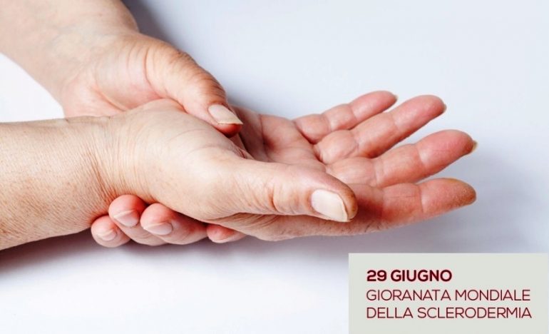 Giornata mondiale della sclerodermia, l’Opi Firenze-Pistoia sostiene la sensibilizzazione sulla malattia