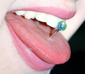 I piercing alla lingua provocano periodontite: i risultati della ricerca