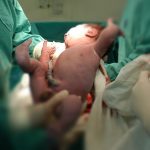 Mantova, parto eccezionale di una donna in coma