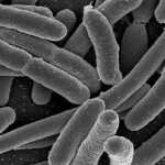 Sindrome Emolitico Uremica (S.E.U.)