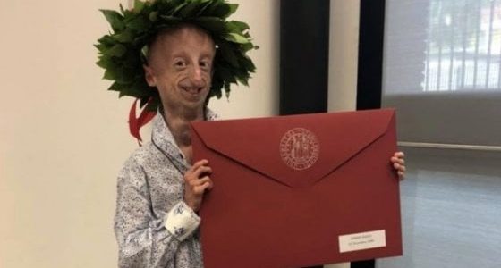 Sammy Basso, volto simbolo della lotta alla Progeria, si laurea con il massimo dei voti