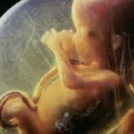 Straordinario intervento neurochirurgico effettuat