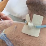 A Roma gli OSS vengono "abilitati" a pratiche infermieristiche invasive