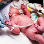 Cordone ombelicale: raccolta di sangue cordonale e implicazioni etiche