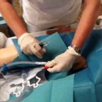 Corso Slow nursing: "Il cateterismo vescicale tra mito e scienza" 1