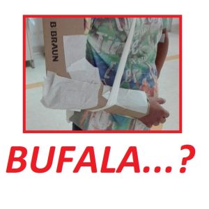 Ingessature col cartone a Reggio Calabria: è una bufala?