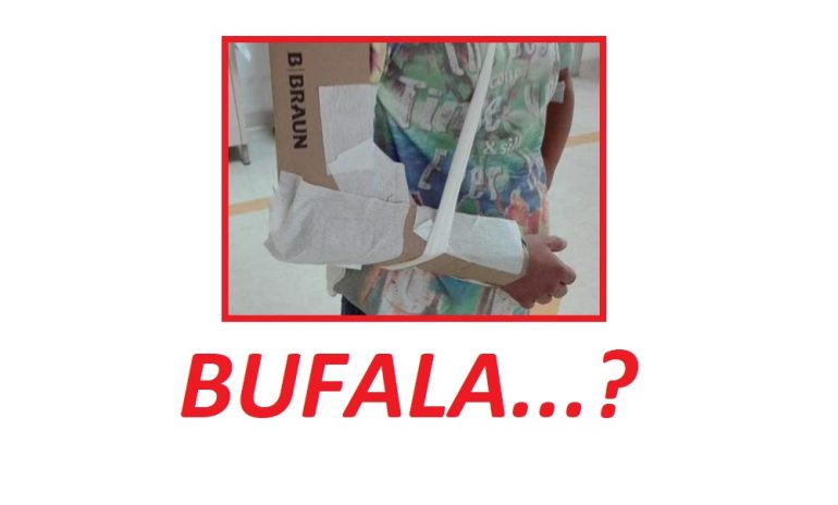 Ingessature col cartone a Reggio Calabria: è una bufala?