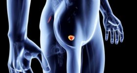 Problemi alla prostata: dieta grassa e colesterolo alto possono esserne la causa