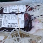 Trasfusione sbagliata, condannati medico e infermiera