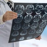 Morta adolescente con tumore: genitori rifiutano chemio perderendo curcuma e incenso